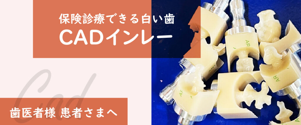 CADインレー
